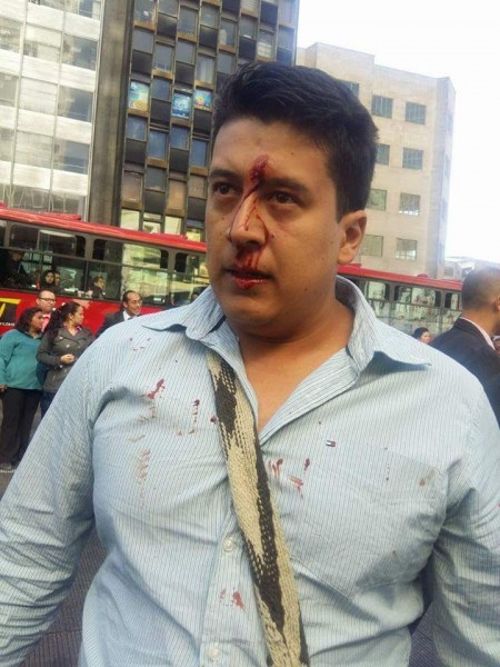 La intevención de los que se dicen llamar 'policías' terminó con resultados como estos. Foto:  Lina Hernández