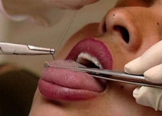 Alerta frente a sistema para bajar de peso