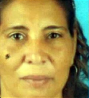 Inés Carrillo, otra mujer quemada con ácido este fin de semana