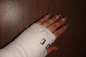 Más cámaras contribuirían a evitar más ataques con ácido