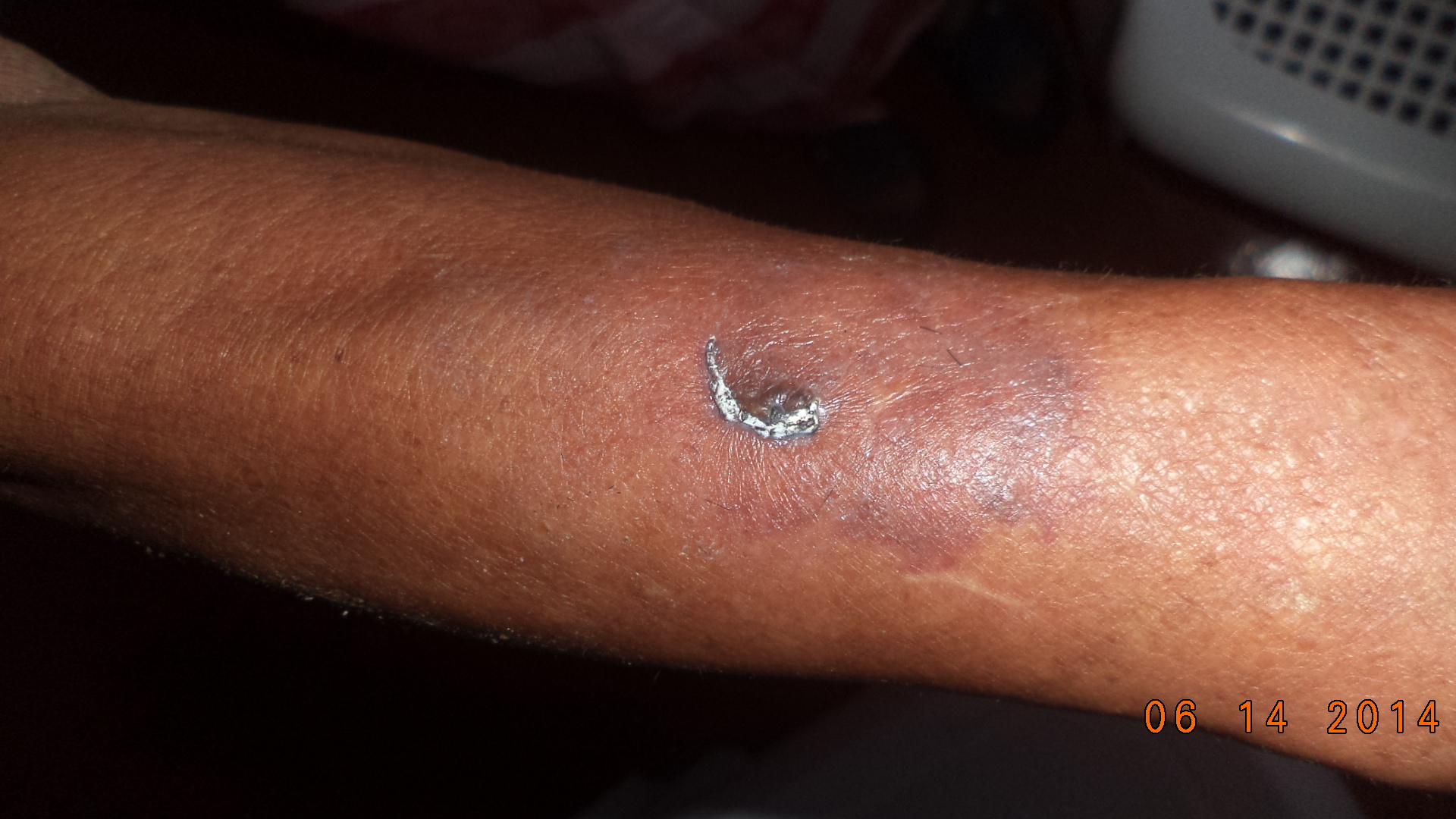 Mujer agrede fisica y verbalmente a los ancianos