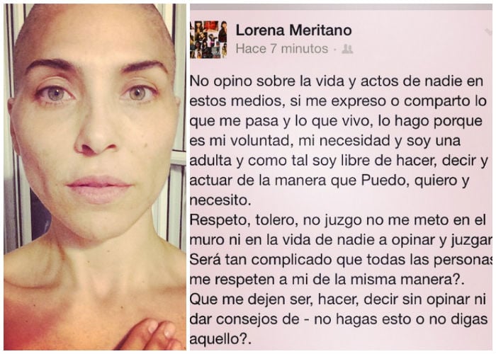 Lorena Meritano muestra su lucha contra el cáncer