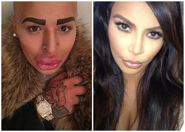 Hombre gasta 300 millones de pesos para parecerse a Kim Kardashian