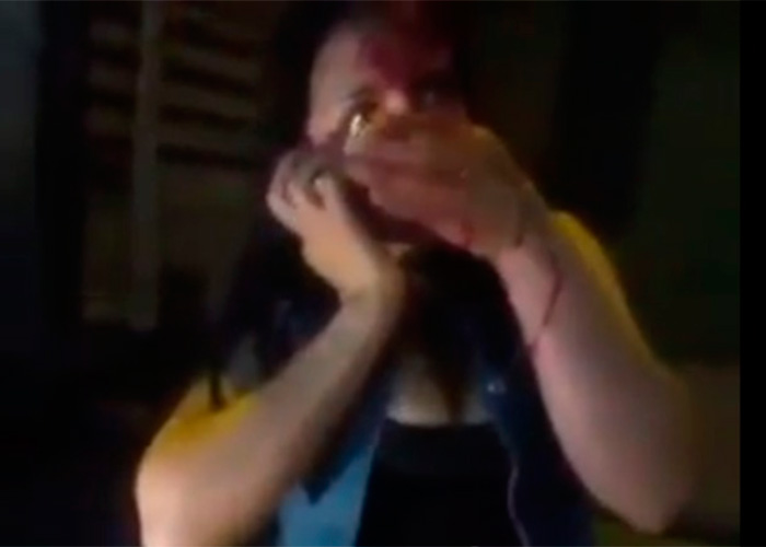 Policía habría golpeado a mujer hasta hacerla sangrar