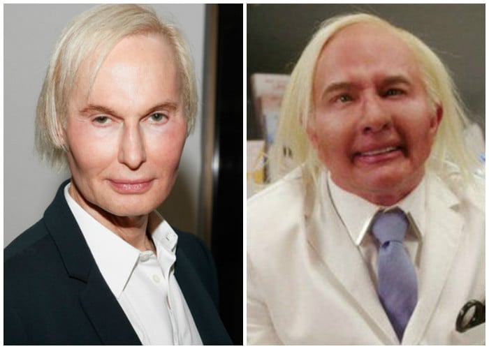 La tragedia detrás del suicidio del rey del botox