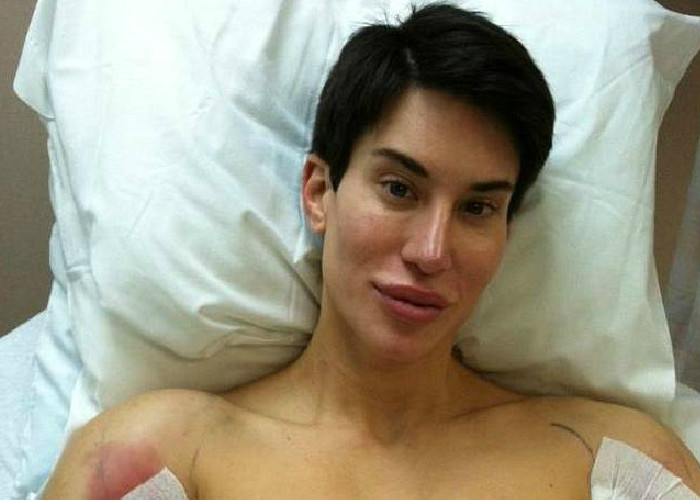 El hombre que quiere ser 100% plástico