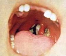  - Dejémonos de vainas, vacunémonos