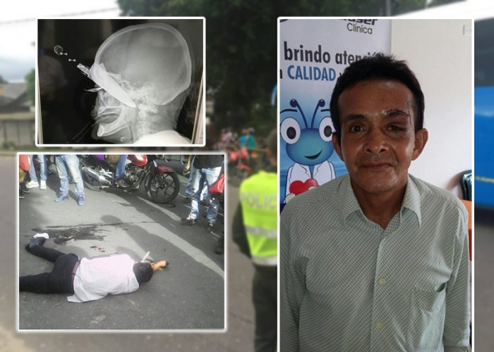 El hombre del cuchillo en la cabeza