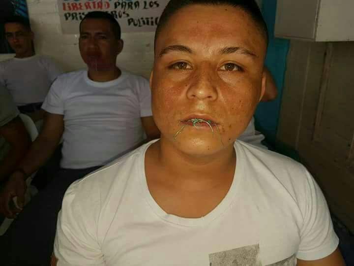 Se agrava la situación de los presos políticos de las Farc en la Picaleña en Tolima