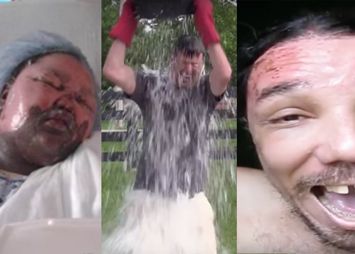 VIDEO: Quemarse la cara con agua hirviendo el nuevo reto en redes