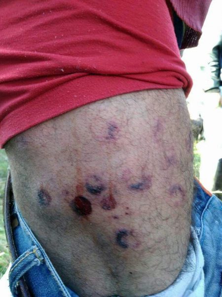  - Después de la plaga de moscas llegó el ESMAD a Ciudad Bolivar en Bogotá