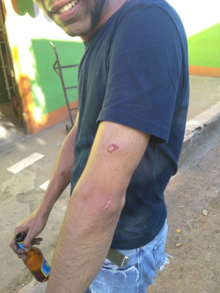  - Después de la plaga de moscas llegó el ESMAD a Ciudad Bolivar en Bogotá