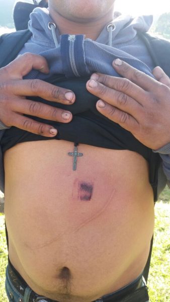  - Después de la plaga de moscas llegó el ESMAD a Ciudad Bolivar en Bogotá