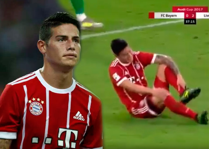 La mala suerte persigue a James también en el Bayern: lesión y separación