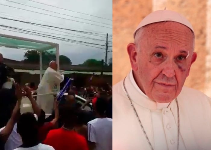 El golpe que sufrió el papa Francisco es culpa de todos los colombianos