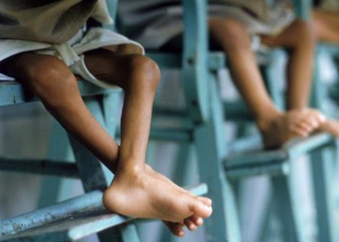 Mala gobernanza, principal causa de la desnutrición