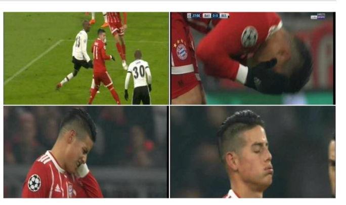 La mala suerte de James Rodriguez