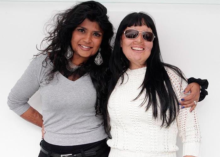 Gina Potes, la primera mujer agredida con ácido en Colombia, transforma sus cicatrices en arte