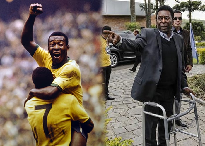 Las enfermedades que están matando a Pelé