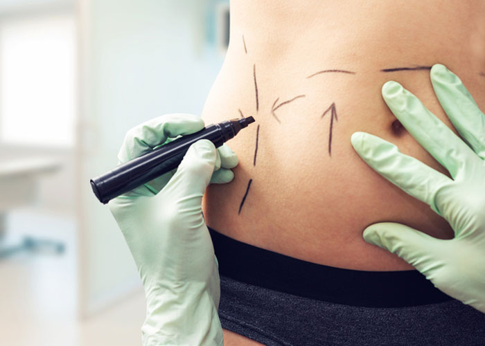 Colombia, en los ojos del mundo por cirugías plásticas y estéticas