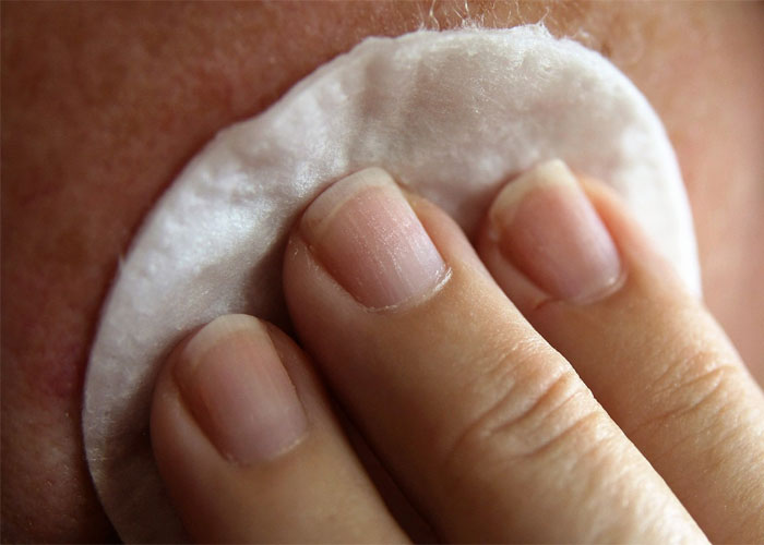 La peligrosa práctica de blanquearse la piel toma fuerza en el país