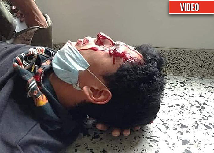 El Esmad vuelve y juega: dejó al borde de la muerte a estudiante