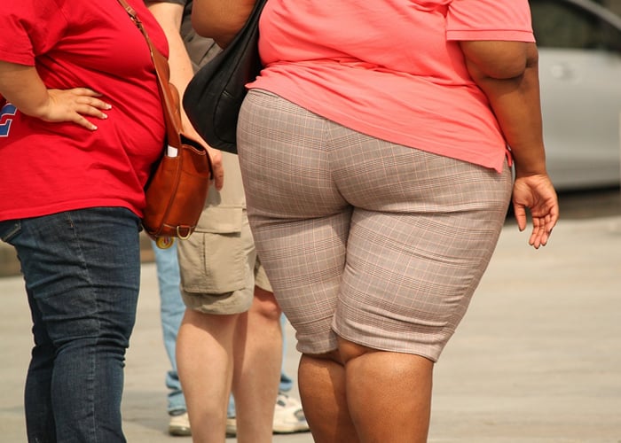 Obesidad, un asunto de peso