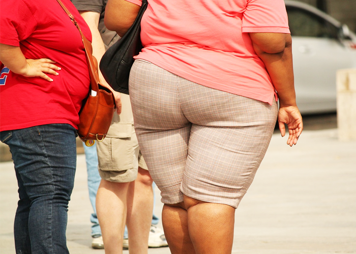 Obesidad, la silenciosa enfermedad que están padeciendo los colombianos