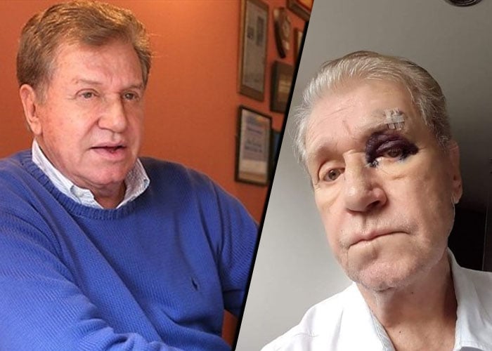 La golpiza que recibió Julio César Luna, gloria de la televisión colombiana