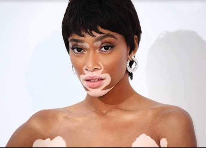 La extraña enfermedad de la nueva novia de Maluma