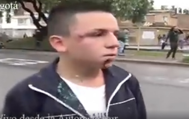Manifestante del paro nacional casi pierde un ojo por culpa del Esmad. Video