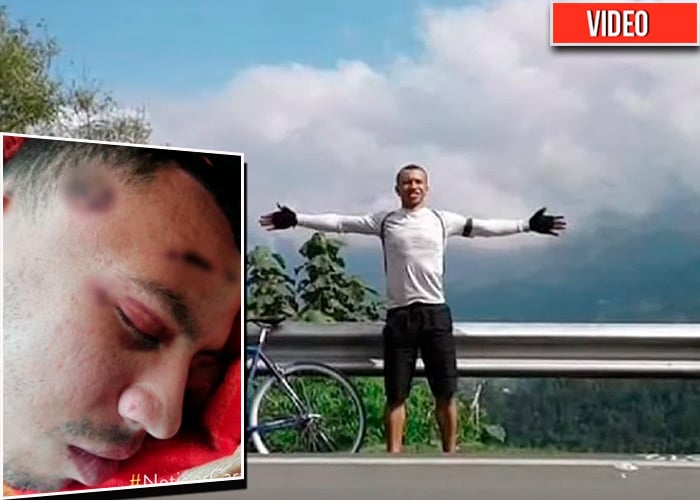 El deportista al que el Esmad le fracturó el cráneo