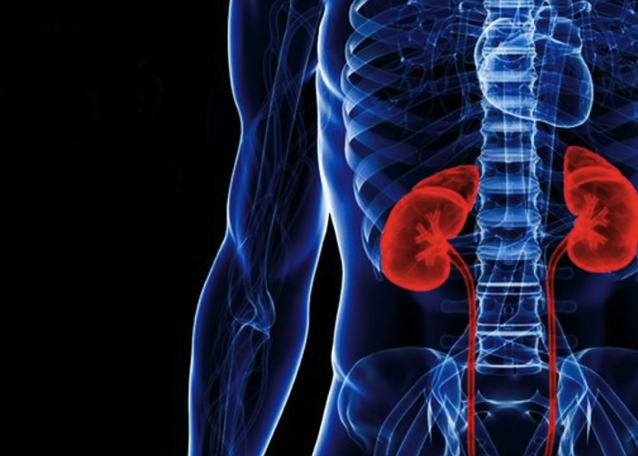 La enfermedad renal crónica está matando a los colombianos