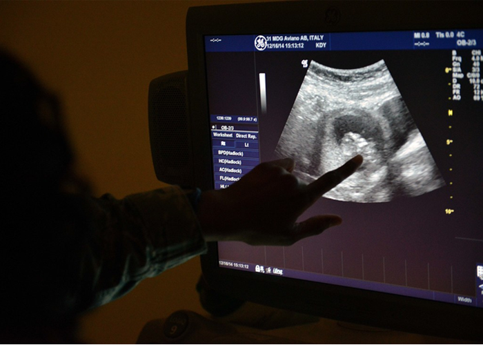 ¿Podría la cirugía fetal reducir el número de abortos por malformaciones?