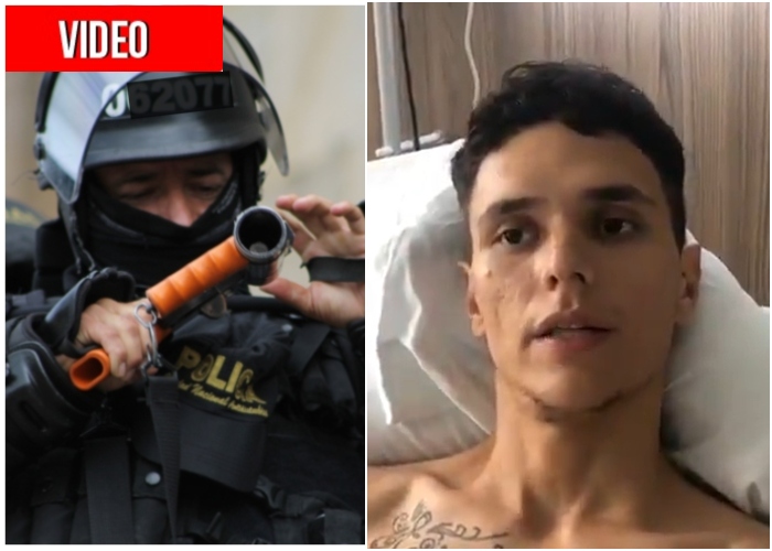 El estudiante al que a un policia dejó en silla de ruedas en Cali