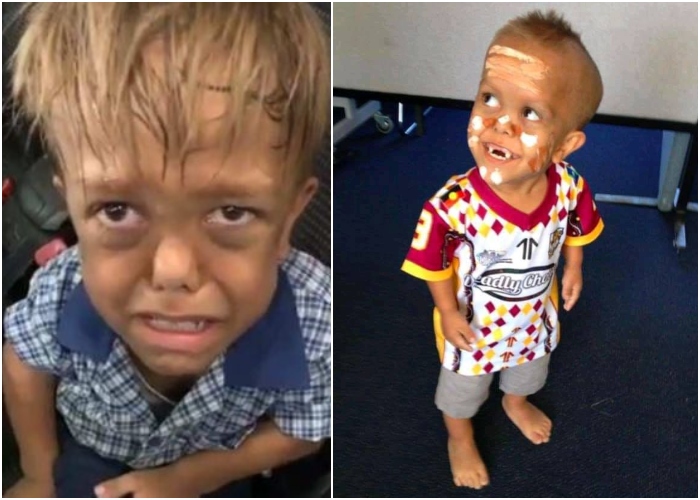 La vida feliz lejos de sus compañeros de clase que lleva Quaden Bayles