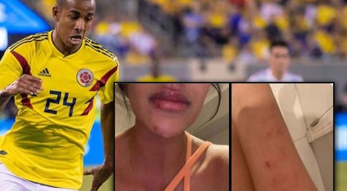  - Las brutales golpizas que Sebastian Villa le habría dado a sus novias. VIDEO