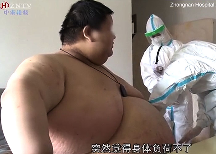 El muchacho que engordó 102 kilos en la cuarentena