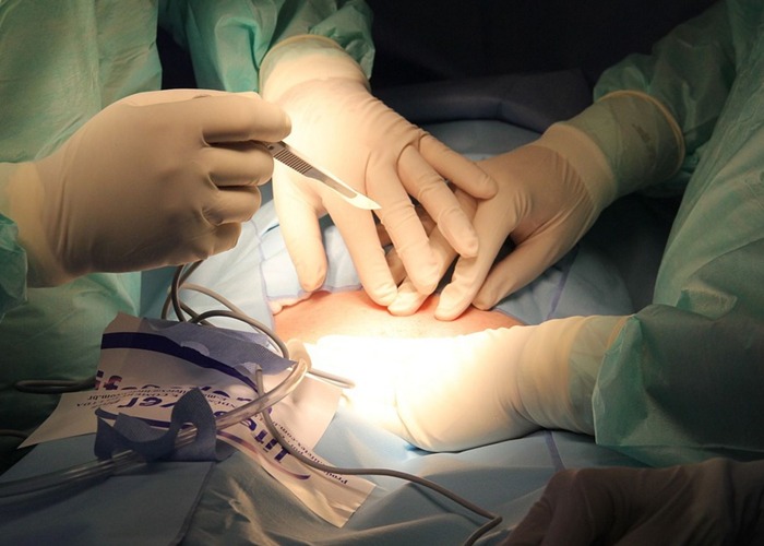 ¿Quienes son los estúpidos que se están haciendo liposucciones en plena pandemia?