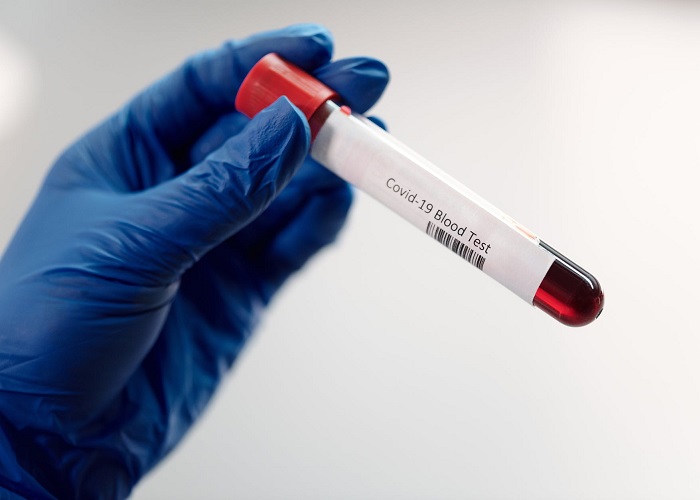 La cuantiosa donación de plasma de cuatro mil miembros de una iglesia surcoreana recuperados de COVID-19