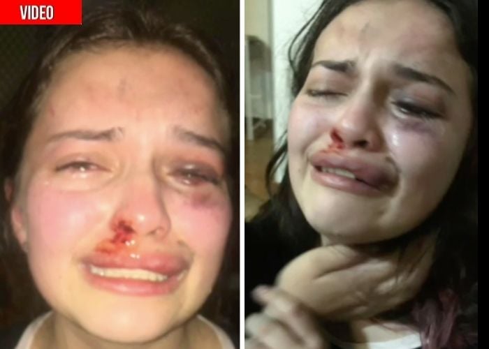 “El esposo de mi mamá casi me mata a golpes”