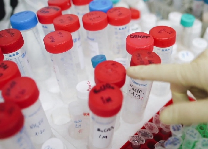 Pruebas COVID-19, en cuidados intensivos