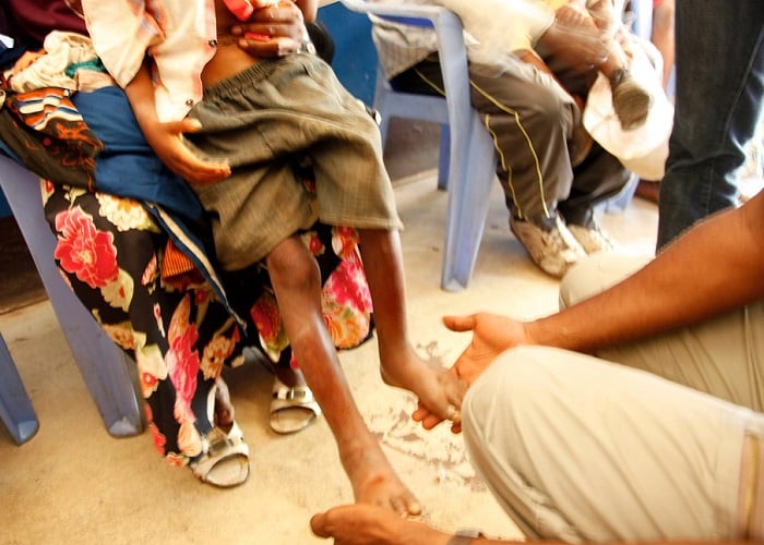 El círculo vicioso de la desnutrición infantil en La Guajira