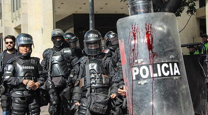  - Los ojos que les saca el Esmad a los jóvenes