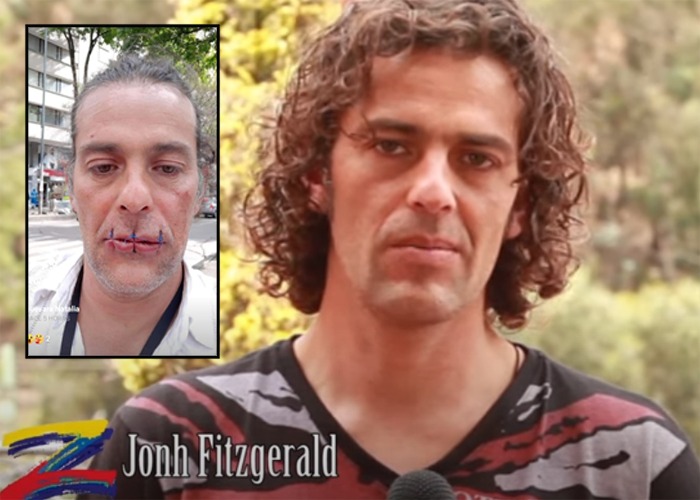 John Fitzgerald, el artista uribista que se cosió los labios