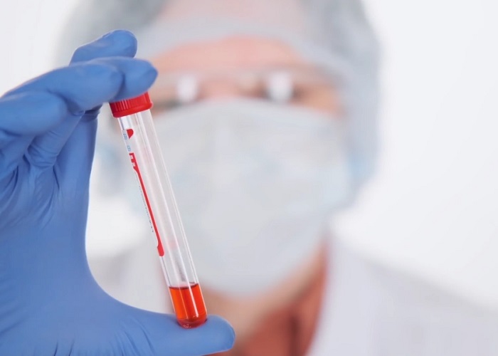 Falta de procesamiento de 18.548 pruebas de COVID-19 habría generado grandes pérdidas