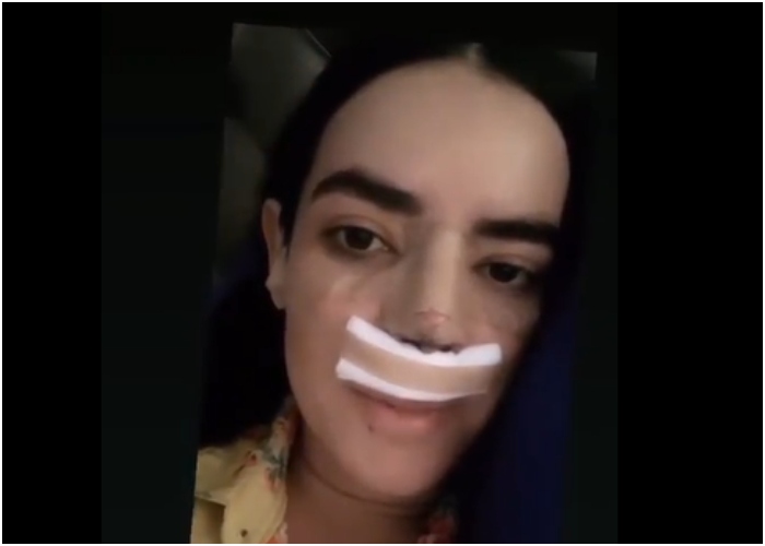 Los dolores de Elianis Garrido tras recientes cirugías