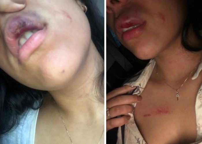 Por celos, acordeonero golpea brutalmente a su novia