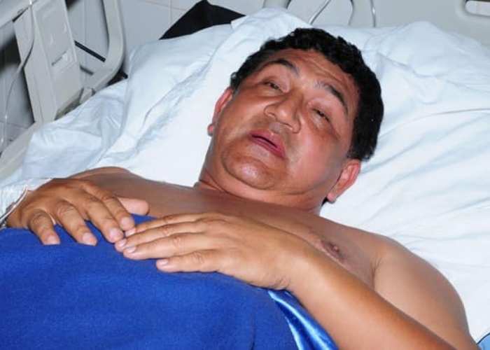 Poncho Zuleta está hospitalizado luego de caerse de un caballo