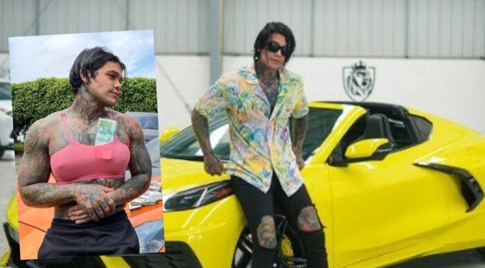  - El carrazo que le dejaron los senos de silicona a Yefferson Cossío